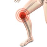 Dolor de espalda: principal motivo de consulta: artrosis heelespana 1 150x150 - HeelEspaña