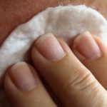 Cómo aliviar el picor vaginal: aliviar picor en la piel heelespana 150x150 - HeelEspaña