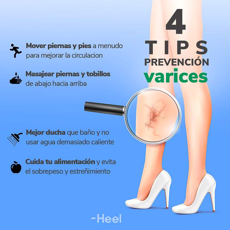 Vid Roja para la circulación de las piernas con varices: prevencion varices consejos - HeelEspaña