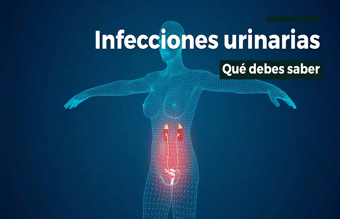 Las infecciones urinarias ¿que debes conocer?