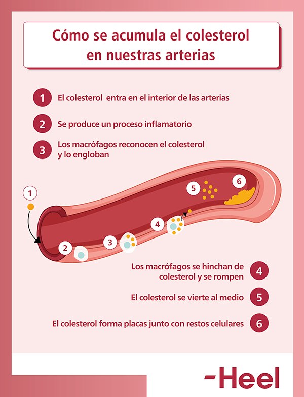 8 síntomas de colesterol alto que no debes dejar pasar: como se acumula el colesterol en nuestras arterias  - HeelEspaña