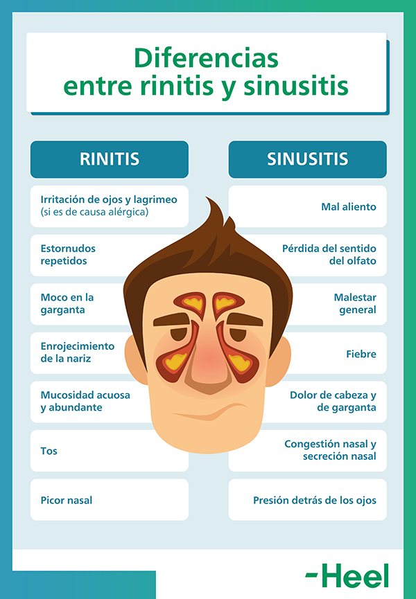 Sinusitis, tratamiento natural: diferencias entre rinitis y sinusitis 2 - HeelEspaña