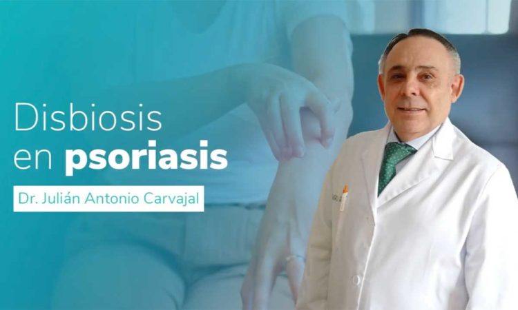 disbiosis-psoriasis