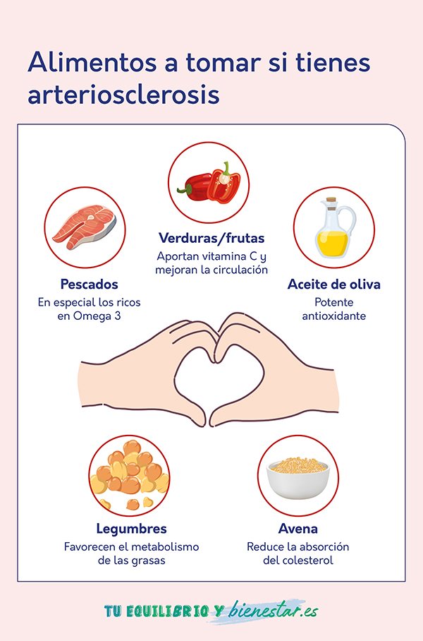 Alimentos que pueden ayudarte con la arterioesclerosis: alimentos tomar tienes arteriosclerosis - HeelEspaña