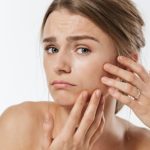 Piel escamada y picor: causas sorprendentes y soluciones efectivas: piel escamosa 150x150 - HeelEspaña