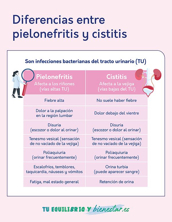 Pielonefritis y cistitis, ¿en qué se diferencian?: diferencias pielonefritis cistitis - HeelEspaña