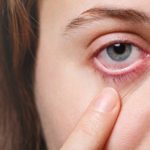 Cómo cuidar tus ojos mientras estas resfriado: consejos y trucos: ojo seco 150x150 - HeelEspaña