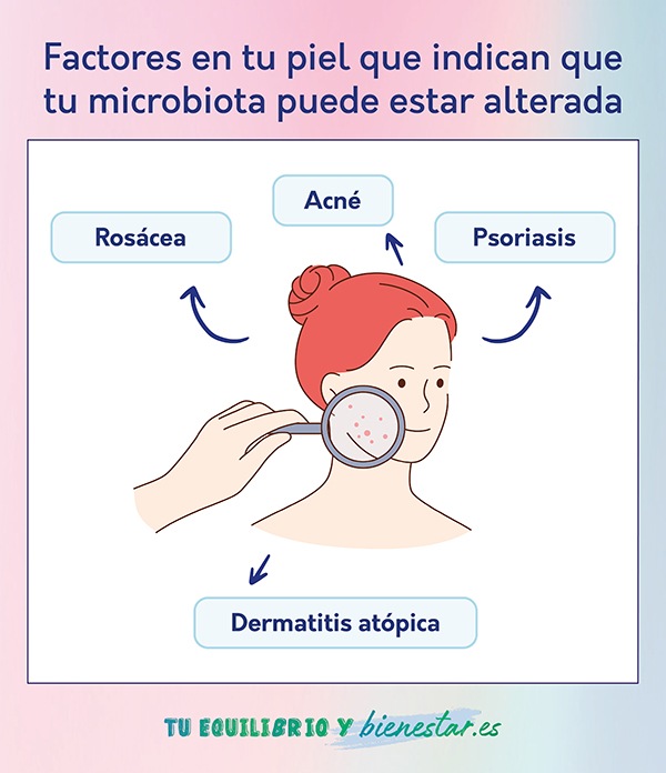 Probióticos y prebióticos para la piel: beneficios y propiedades: factores piel indican que microbiota puede estar alterada - HeelEspaña