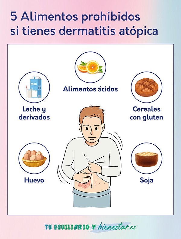 Cómo los probióticos pueden ayudar en el tratamiento de la dermatitis atópica: 5 alimentos prohibidos dermatitis atopica - HeelEspaña